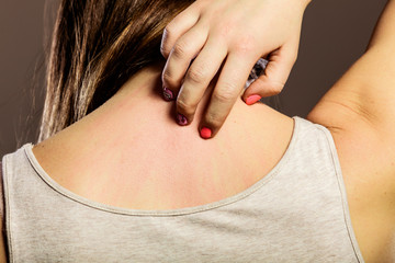 Woman scratching her back closeup