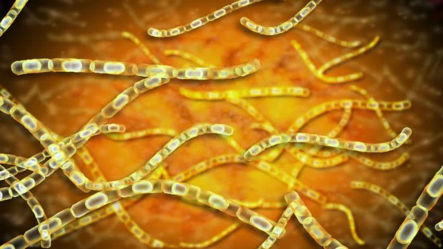 Microscopic visualization of anthrax. Anthrax is an acute disease caused by the bacterium Bacillus anthracis. Most forms of the disease are lethal, and it affects both humans and animals.