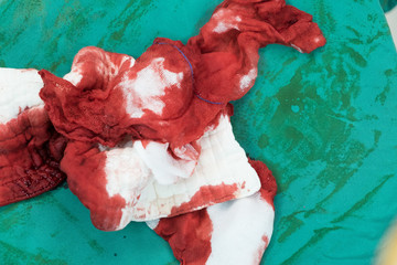 gauze in surgery