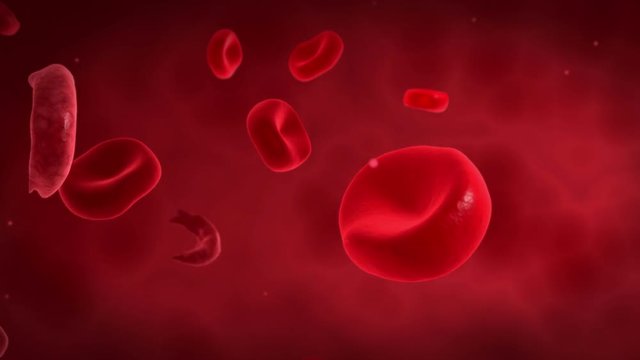 Microscopic visualization of sickle cells causing anemia disease.