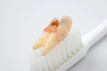 teeth Caries on white background