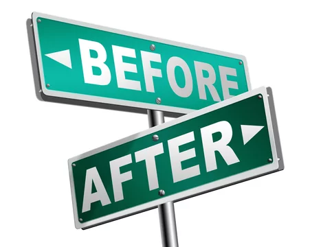 before after comparison Stock Illustration | Adobe Stock