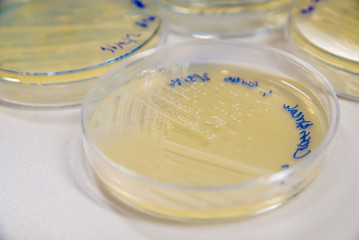 Methicillin-Resistant Staphylococcus aureus (MRSA) cross-streak culture on an agar plate. Medical microbiology concept.