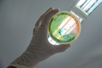 A clinical microbiologist holds up an MacConkey agar plate containing multidrug-resistant (MDR)...