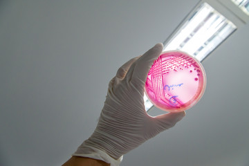 A microbiologist holds up an MacConkey agar plate containing Enterohemorrhagic Escherichia coli (EHEC), a foodborne pathogen that causes severe diarrhea, against the light for identification. - 118191288