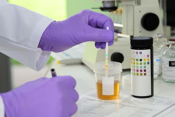 Doping und Drogentest mit Urinprobe im Labor mit Urinteststreife