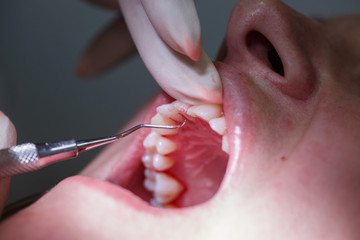 Patient at dental hygienists office - 118340821