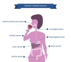 Obraz premium Alcohol related cancers infographics. Woman silhouette drinking wineglass
