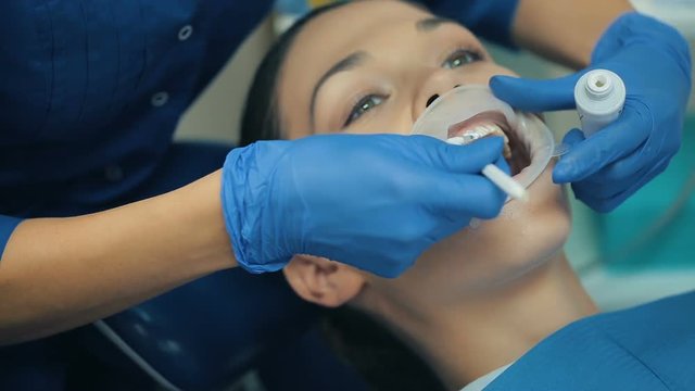 Woman with rubber dam in a mouth at a dentist