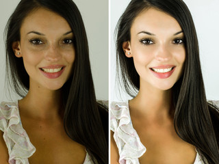 Portrait of a beautiful brunette girl before and after retouching with photoshop. Bad photo vs good photo, acne beauty treatment. Edited photos being compared. - 118497001