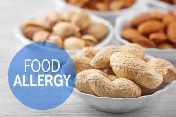 Allergy danger concept. Different kinds of nuts in bowls on white wooden background. Text food allergy.