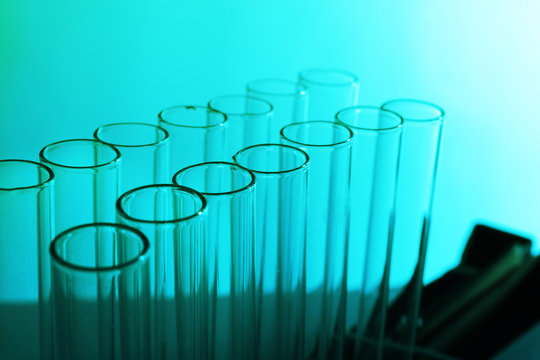 Test tubes on blue background