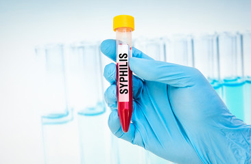 Test-tube with blood sample for SYPHILIS test