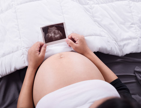 pregnant woman with ultrasound image of baby sitting on bed in b