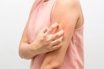 Women scratch the itch with hand ,arm, itching, Concept with Healthcare And Medicine.