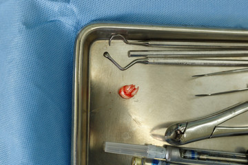 Dental tools and tooth on steel plate.Dentistry and medical background.