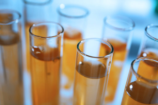 Test Tubes With Contaminated Water Closeup