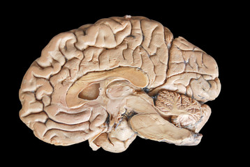 Real human half brain anatomy isolated on black background