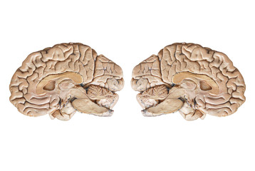 Real human half brain anatomy isolated on white background