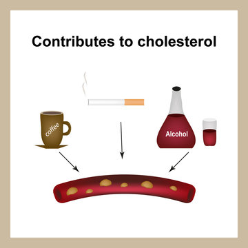 Coffee, cigarettes and alcohol raise cholesterol levels in the blood. Cholesterol plaques. Infographics. Vector illustration