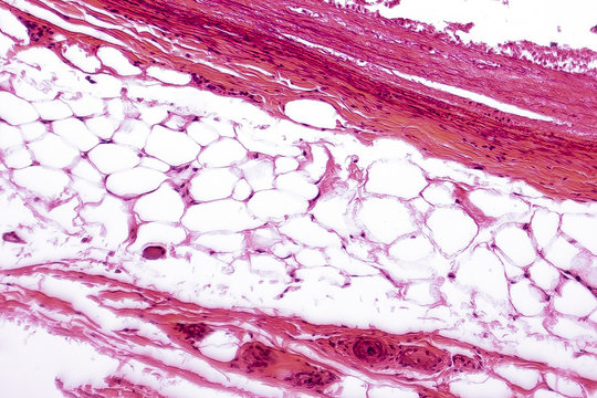 White adipose tissue, light micrograph, hematoxilin and eosin staining, magnification 100x. Fat cells (adipocytes) have large lipid droplet which remains unstained