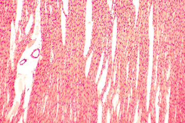 Heart muscle, light micrograph. Striated cardiac muscle cells (myocytes). Light microscopy,...