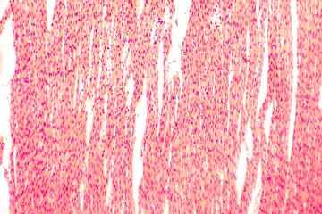 Heart muscle, light micrograph. Striated cardiac muscle cells (myocytes). Light microscopy, hematoxilin and eosin stain, magnification 100x