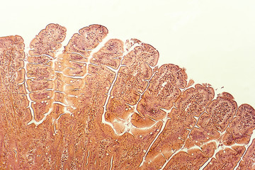 Villi of small intestine, light micrograph, magnification 40x