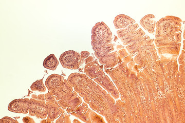 Villi of small intestine, light micrograph, magnification 100x