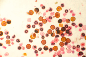 Eggs of tapeworm Taenia (pork tapeworm), a helminth transmitted to humans by raw or undercooked...
