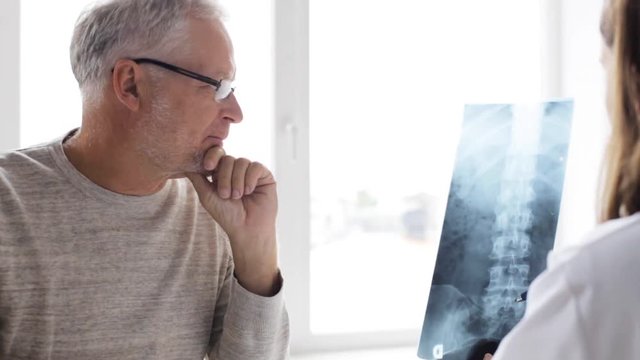 doctor with spine x-ray and senior man at hospital 75