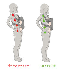 posture of a woman who has a child in a bag (sling) at breasts. correct and incorrect posture. vector illustration.