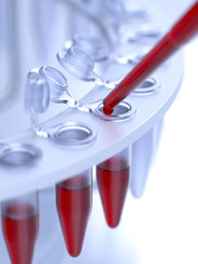 Laboratory blood test