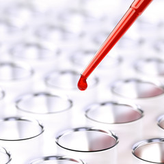 Laboratory blood test