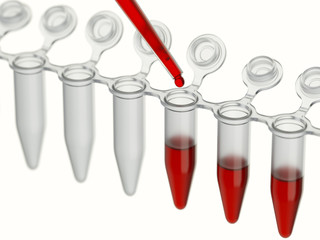 Laboratory blood test