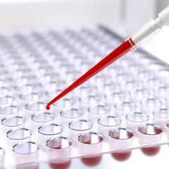 Laboratory blood test