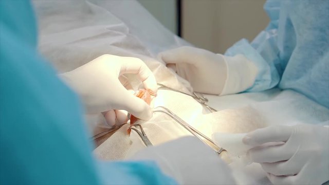 electrosurgery tool in surgeon's hand