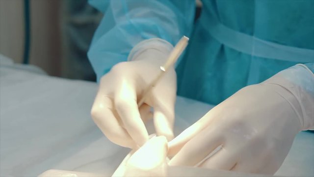 electrosurgery tool in surgeon's hand