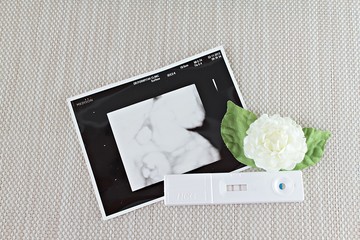 New born baby at ultrasound scan of baby, positive pregnancy test and white jasmine flower on...