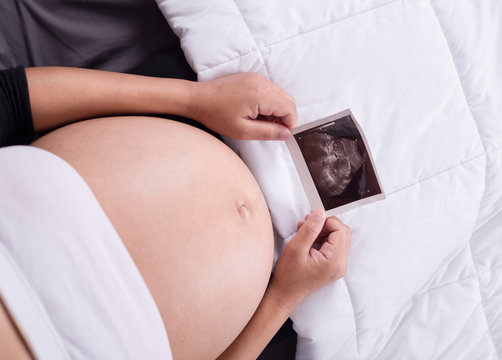 pregnant woman with ultrasound image of baby sitting on bed in b