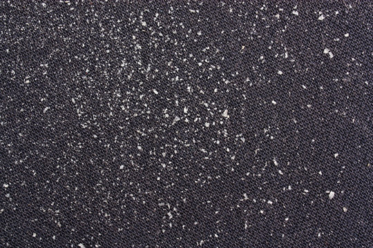 Pieces Of Dandruff On Clothes