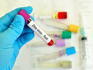 Naklejka premium Test tube with blood sample for Zika virus test 