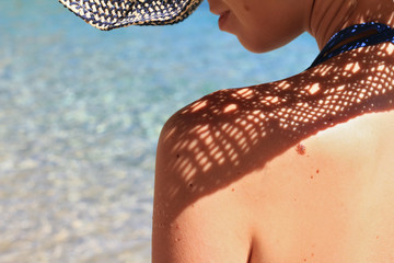 Beautiful Woman with birthmarks on her back and face. Attractive female wearing straw hat on the...