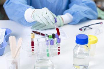scientist analyzing test samples in a laboratory