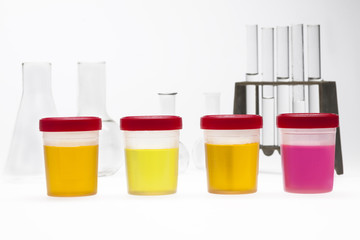 doping test of urine on laboratory