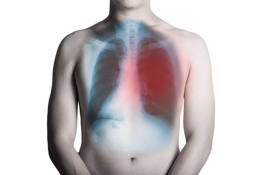 Man and an x-ray with red mark lung isolated on white background