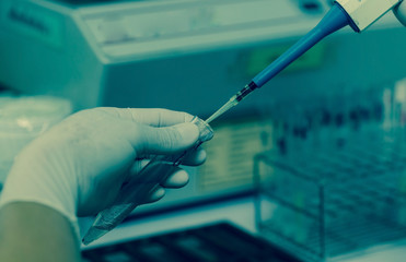 Close up hand holding test tube and pipette in laboratory on blue background.