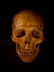 Human skull