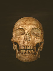 Human skull