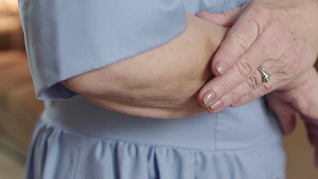 A senior woman - victim of physical elder abuse and domestic violence - uses her hand to cover a bruise on her arm. Shot in 4K UHD.